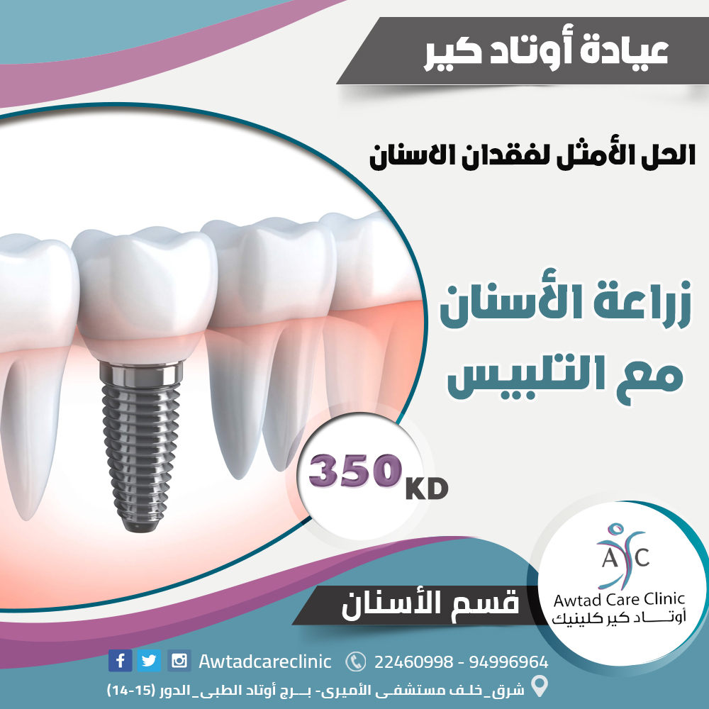 زراعة الأسنان | أفضل عيادة أسنان بالكويت | awtadcareclinic