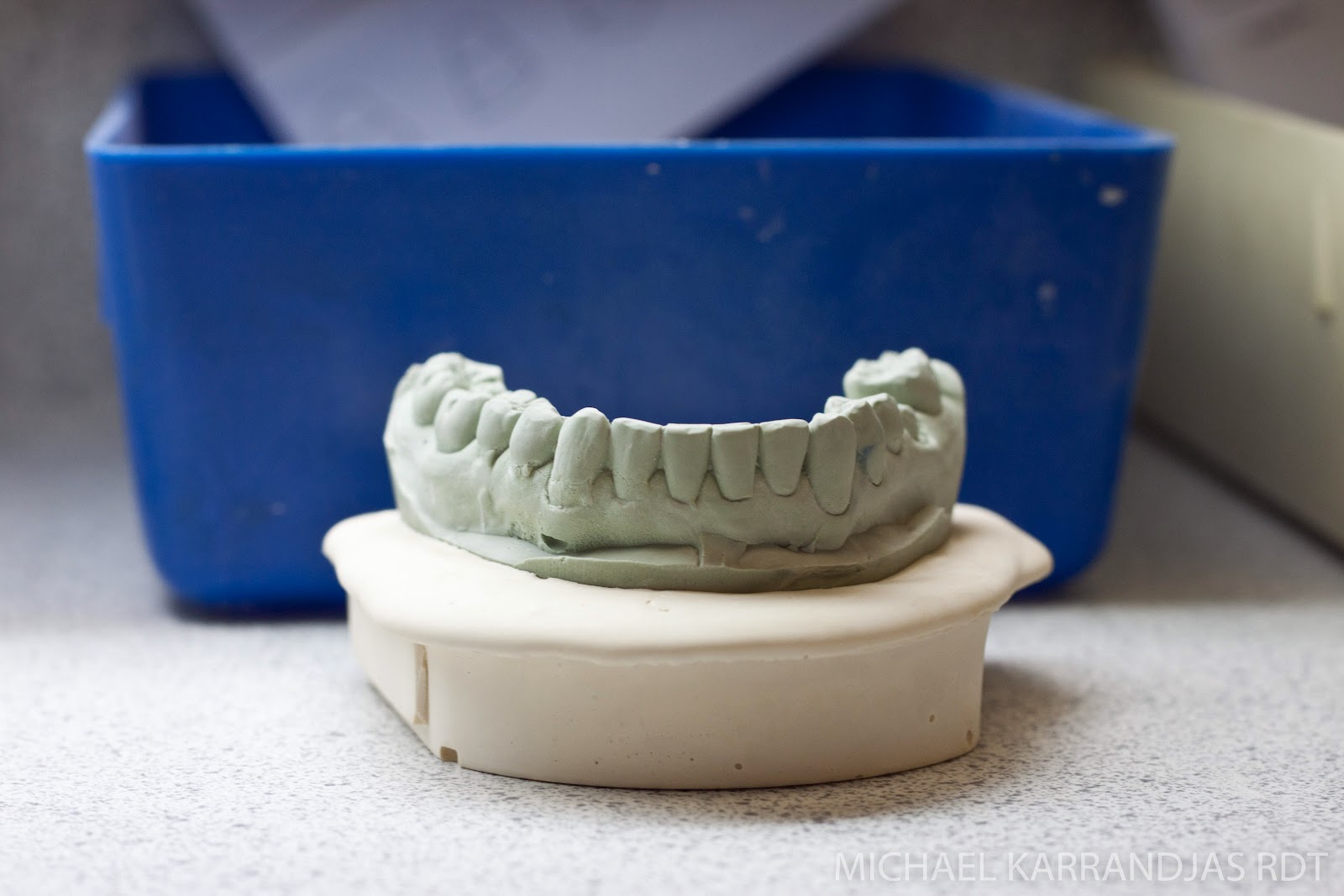 Dental Lab Model Fabrication | Making Noise And Drinking Beer