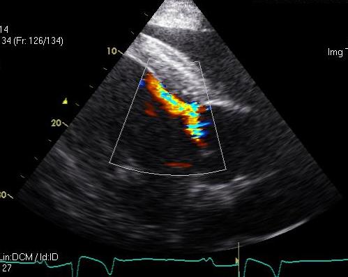 Michael Porter, Equine Veterinarian: Aortic Valve Insufficiency in a Horse