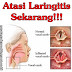 Obat Laringitis Herbal Alami Paling Aman
