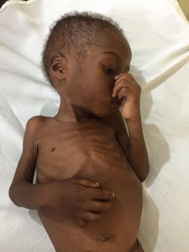 And slowly, he began to get better - Heartbreaking Moment When A 2-Year-Old Left To Die Is Given Water In Nigeria And slowly, he began to get better - Heartbreaking Moment When A 2-Year-Old Left To Die Is Given Water In Nigeria