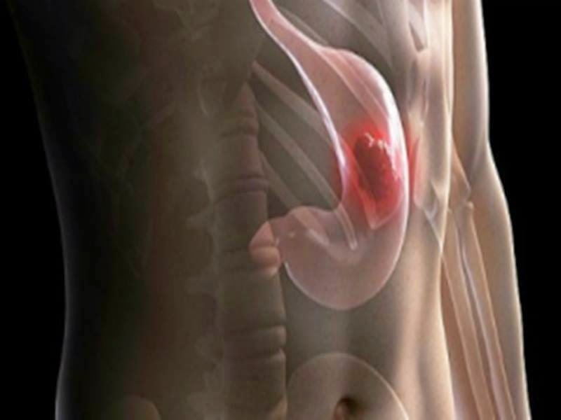 科學家首次實驗室內培育出功能性人胃 Laboratory functional human stomach