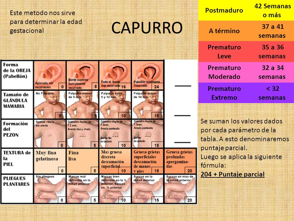 Capurro