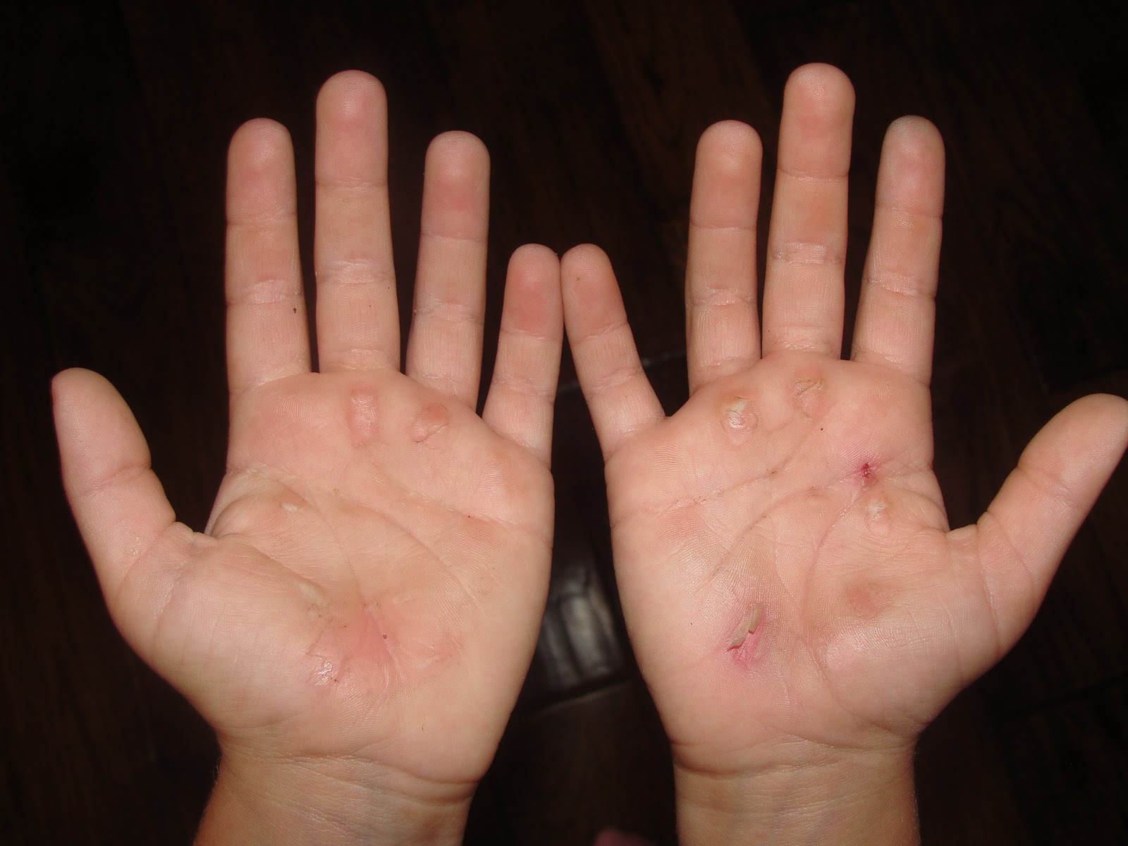 A Human Doing Gymnast hands