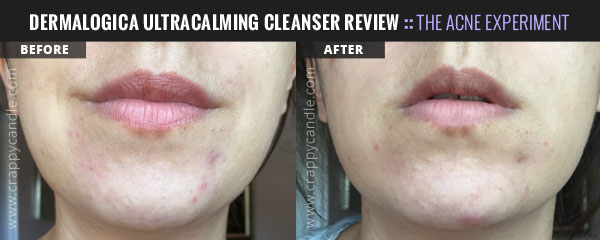 dermalogica ultra calming cleanser dermalogica ultra calming cleanser