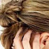 كيفية علاج القشرة في الشعر