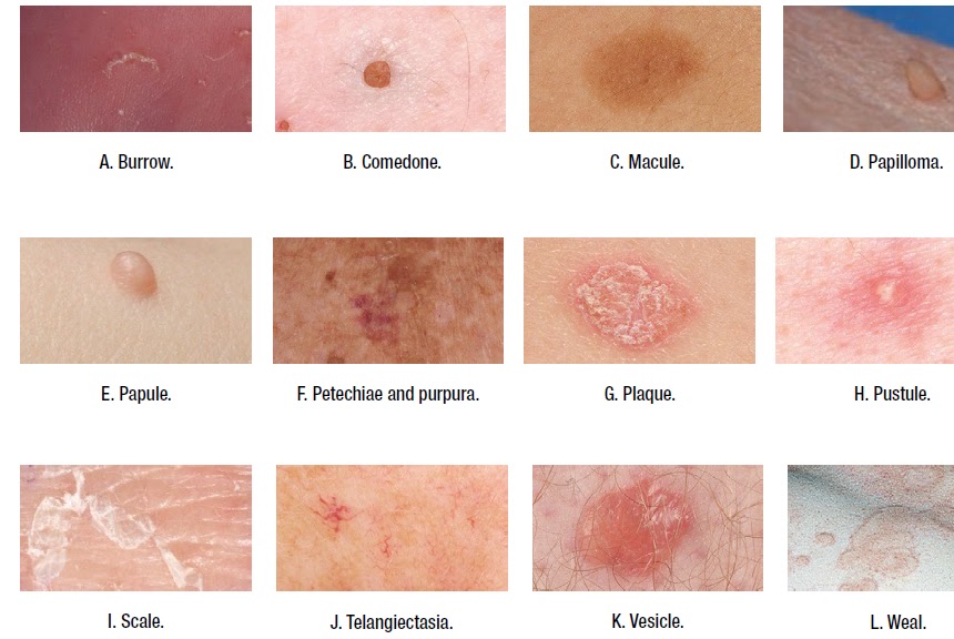 Medical Addicts: Terms used to describe skin lesions