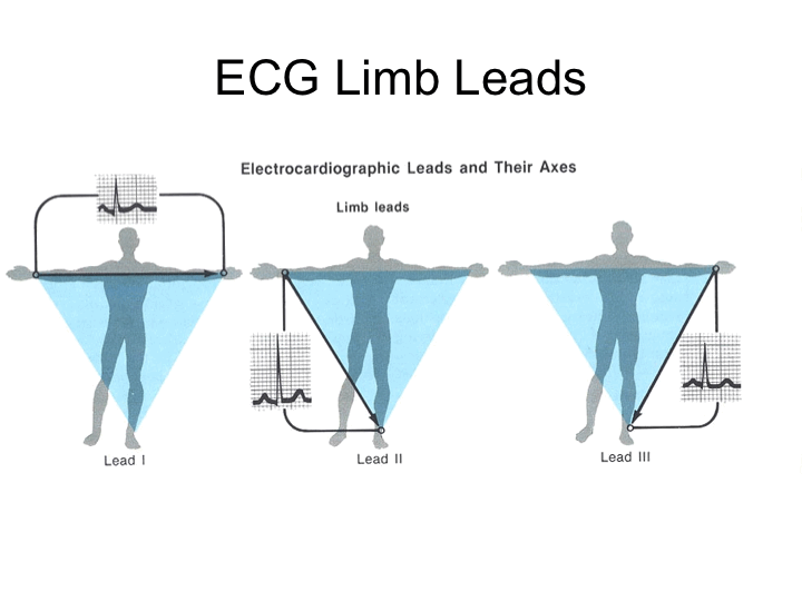 ECG ( Electocardiogram ) 12 leads ECG Med Club