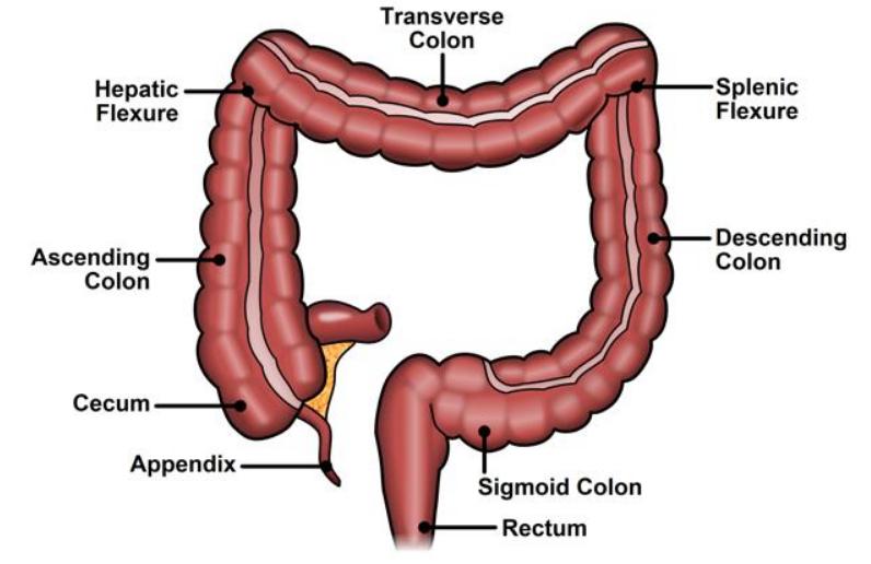 Hereditary Nonpolyposis Colorectal Cancer