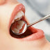 Odontogenic Myxoma Definition, Symptoms, Causes, Treatment