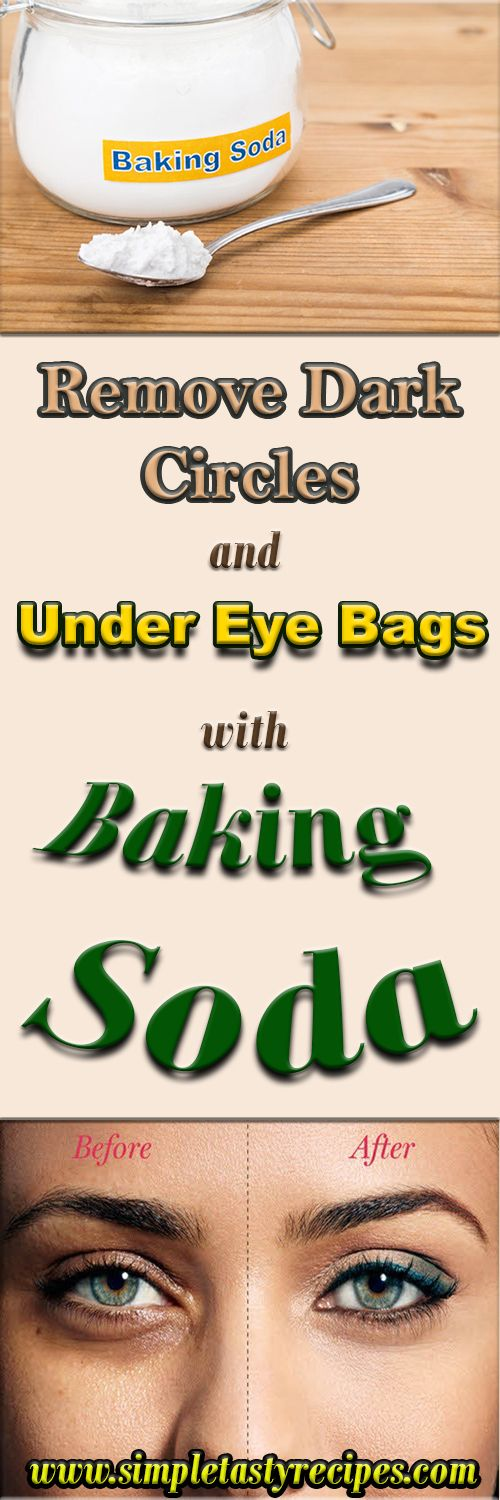 Remove Dark Circles And Under Eye Bags With Baking Soda HEALTH AND