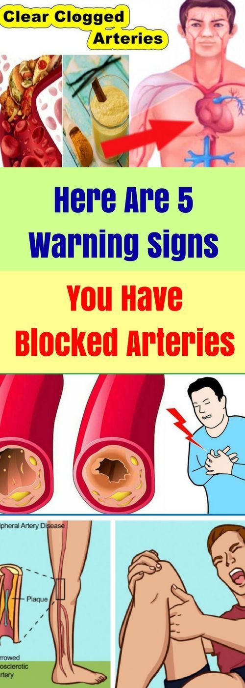 Here Are 5 Warning Signs You Have Blocked Arteries!!! Lizy Style