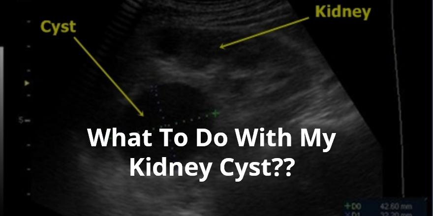 Wellness Lab Health Info: What To Do With My Kidney Cyst??