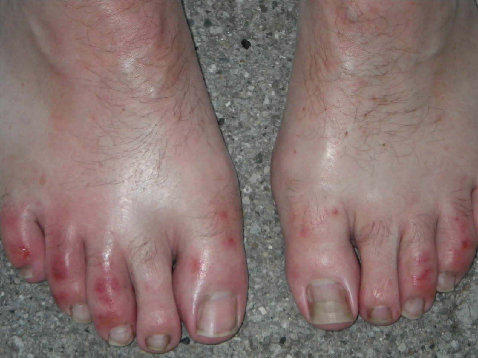 Ugly Feet Pictures 113