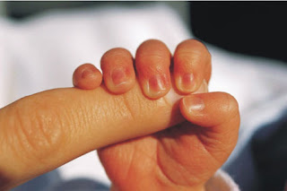 gemelos mellizos criando múltiples crianza trillizos uñas