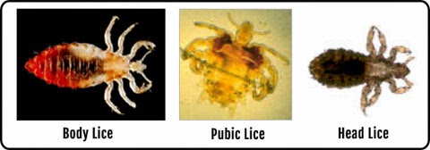 mpd 3233 vector and pest control lice types of lice