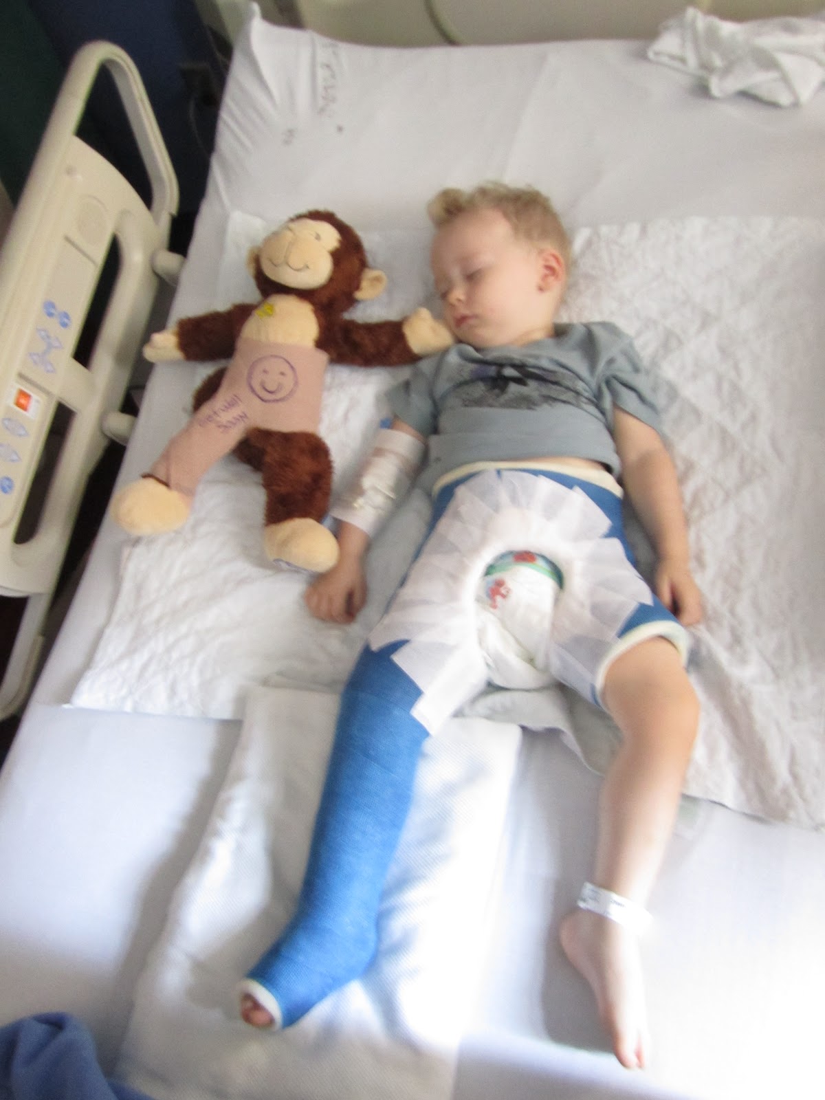 Perfectly Peyton Broke Leg Boy (Peyton's Spica Cast)