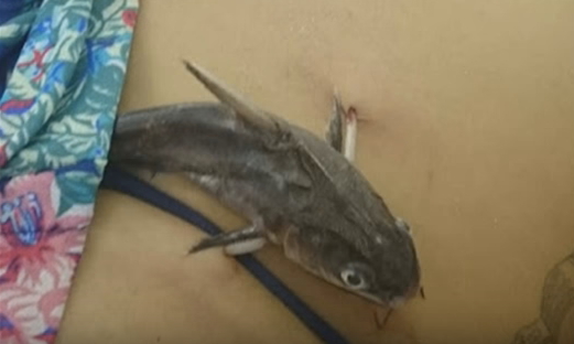 catfish attack brazil