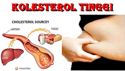 Gambar Kolesterol