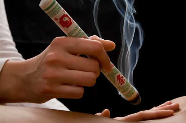 Moxibustion treatment