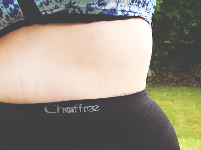 *How To Get Rid Of Chafing With Chaffree