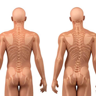 postural deformities