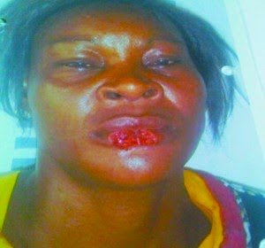 Ada Joy Samuel whos Photo: Woman bites off another woman's lip over gossip in Lagos