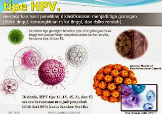 Kutil Kelamin Virus HPV Menyebabkan Kanker