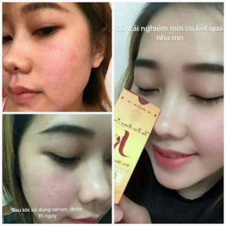 serum Kiều beauty queen serum Kiều beauty queen