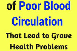 Warning Signs Of Poor Blood Circulation That Lead To Grave Health Problems!!!