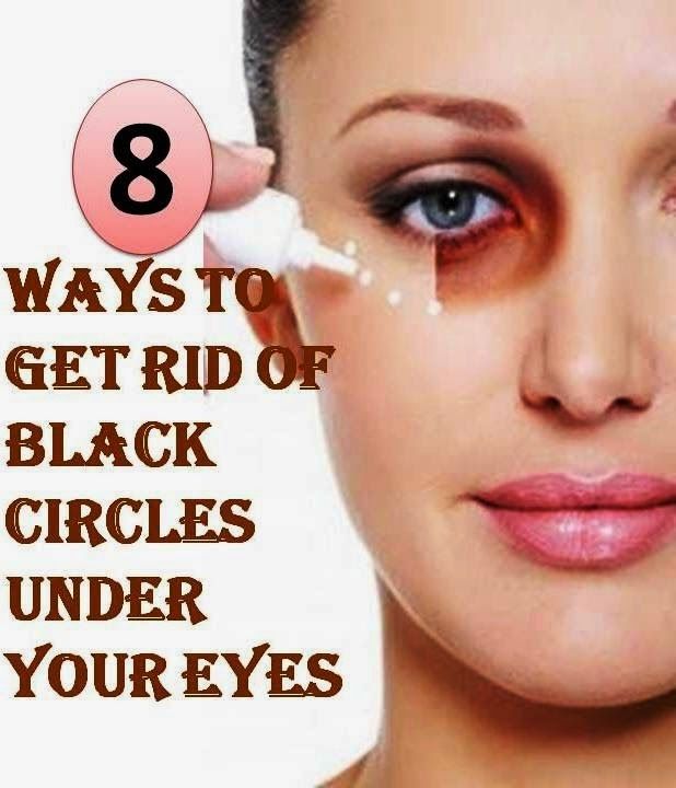 How To Get Rid Of Black Under Eyes 14