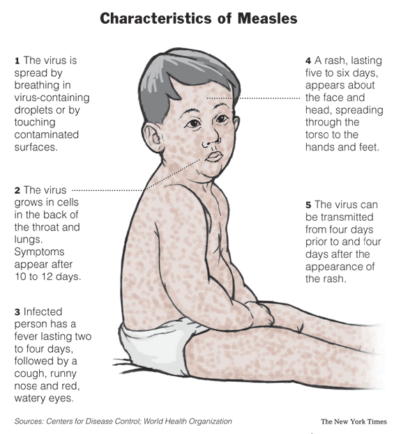 Skin rashes and fever in adults could signal life ...