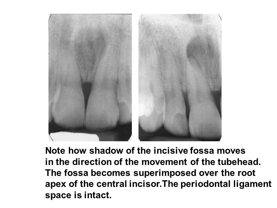 Dentistry Oral Radiology