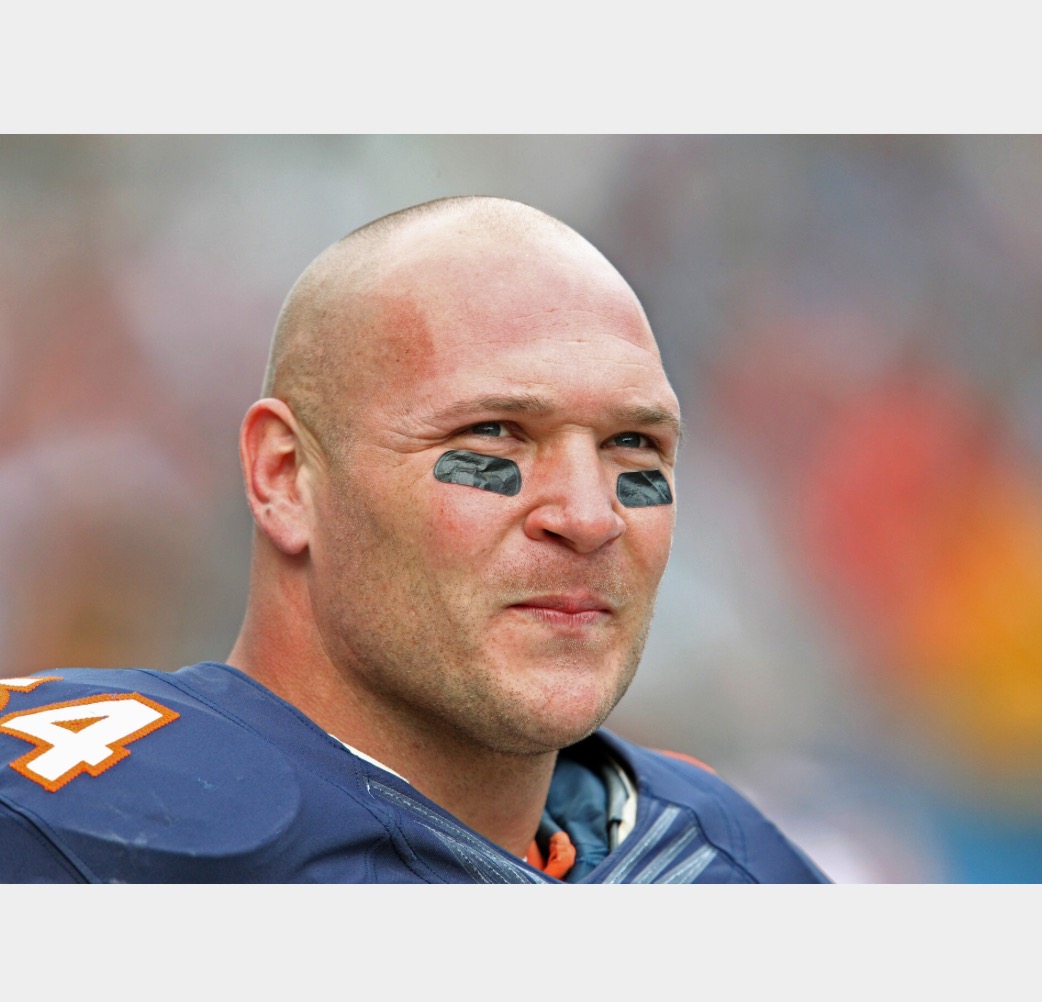 Celebrity Hair and Hairloss: Brian Urlacher got Hair Transplants!!