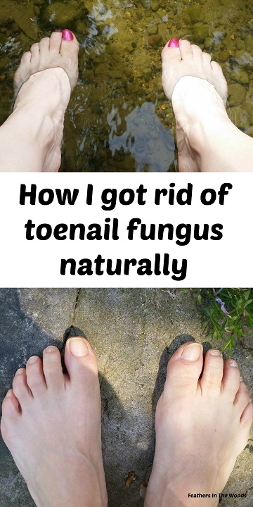 Essential Oils for Nail Fungus : r/Toenail_Fungus