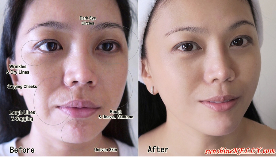 Sunshine Kelly Beauty Fashion Lifestyle Travel Fitness Eucerin Hyaluron Filler Elasticity Review Results Vs Expectations