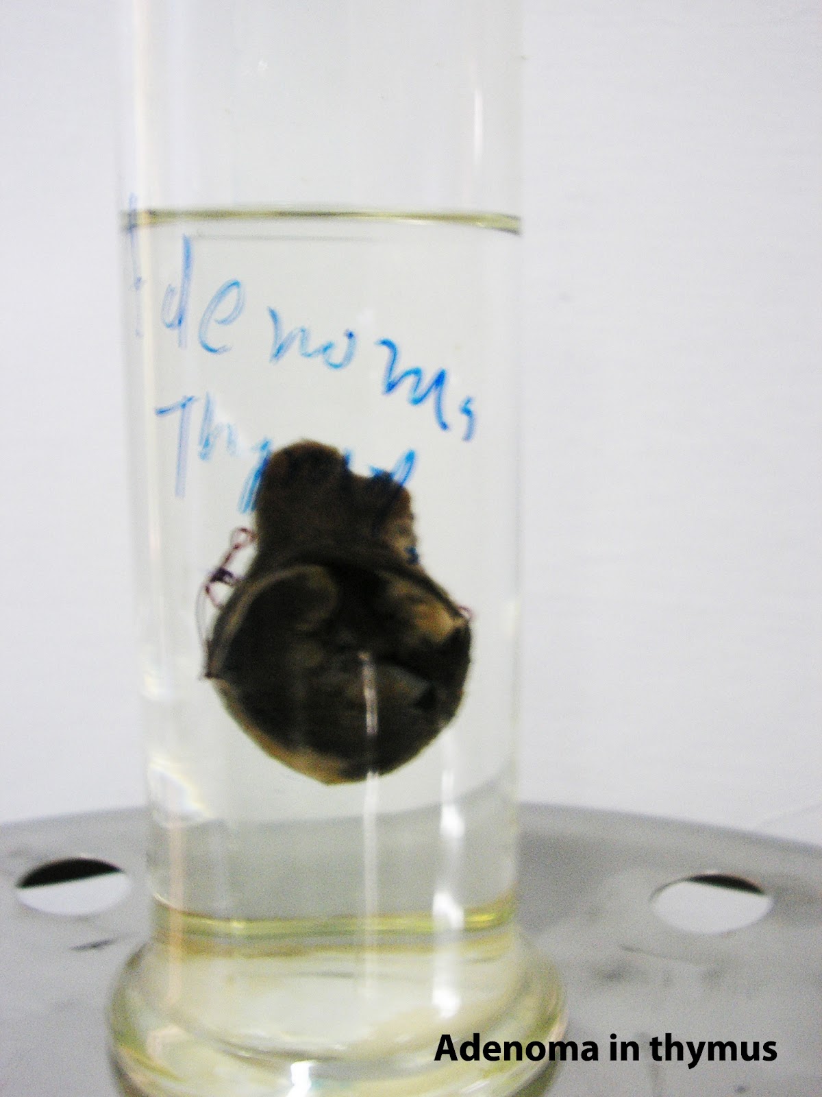 Medical Education for Students Gross Specimens General Pathology (50