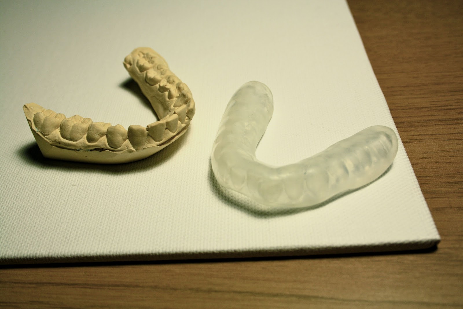 TMJ diaries TMJ in the UK