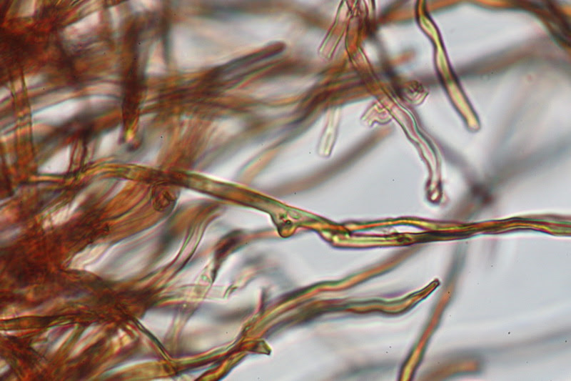 El mundo microscópico de los hongos Gloeophyllum sepiarium (Fr)Karst