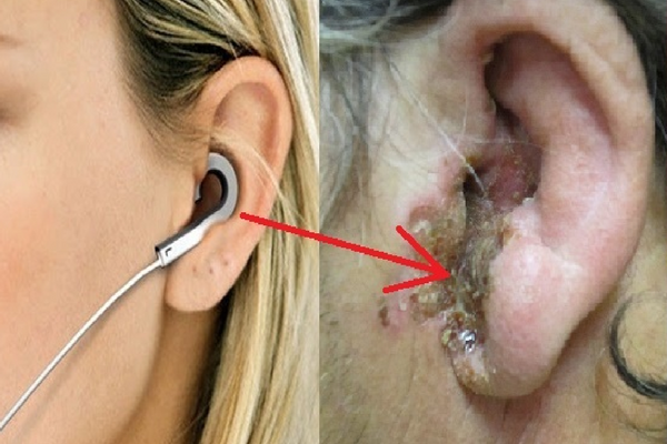 Tak Main-main, ini Bahaya Mendengarkan Musik Dengan Volume Tinggi Pakai `Earphone` Tak Main-main, ini Bahaya Mendengarkan Musik Dengan Volume Tinggi Pakai `Earphone`