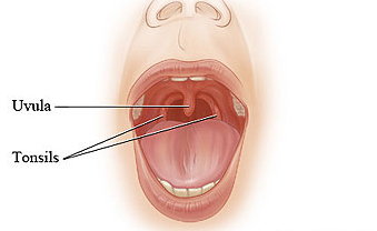What are the Harmful Effects of Throat Abscess