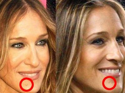 Sarah Jessica Parker Nose Job: Could Sarah Do Without It?