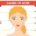 ACNE may be dangerous