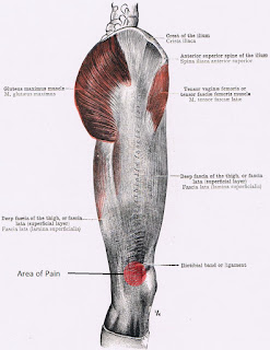 Anatomy of the Sinew Channels: Iliotibial Band Friction Syndrome: A