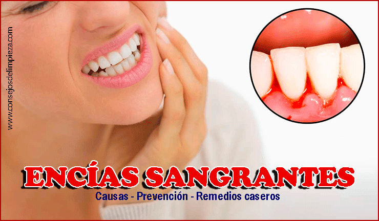 Como detener una hemorragia dental