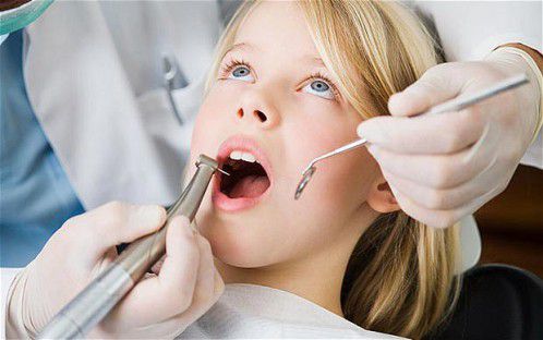 Giải pháp chữa sâu răng ở trẻ em