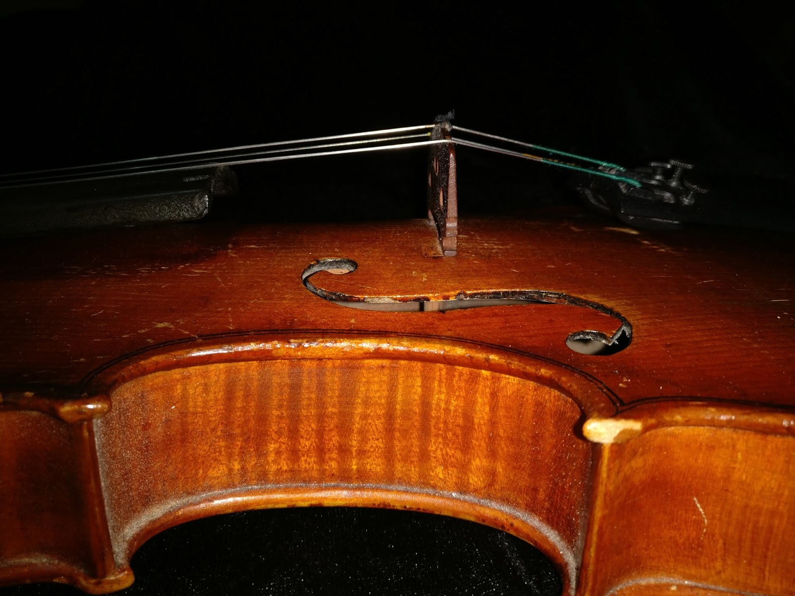 Lap Surgeon VIOLIN MATTERS THE SOUND POST