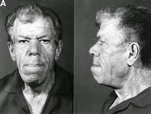 Creation The Written Truth NEANDERTHAL BROKEN HILL SKULL RHODESIA Neanderthal%2Bacromegaly%2Bside%2Bfront
