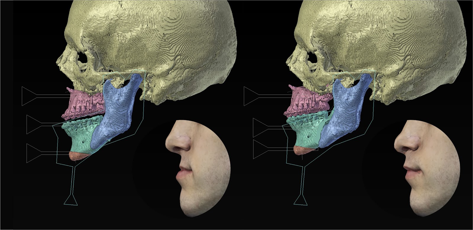 ATOR "Cork on Blender" the addon that has saved lives is available to