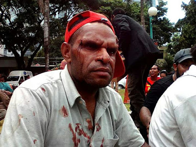 Polisi Tahan Surya Anta Ginting Deklarator Referendum Papua